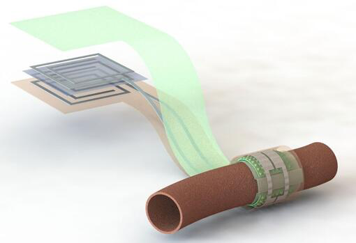 上圖描繪了這款可生物降解的壓力傳感器，它圍繞著一根血管，天線在左側(分離的層狀結構，展示了天線結構的細節)